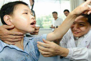 黑龙江婴儿癫痫的早期症状是什么